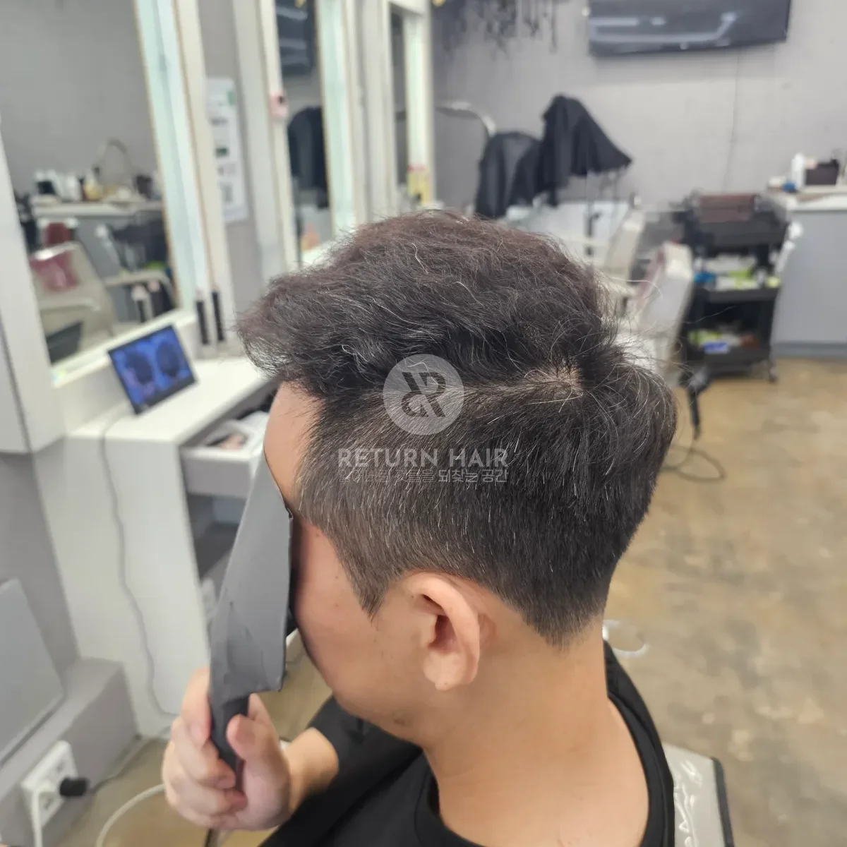 탈모 치트펌 파마 시술 후 결과 사진 5