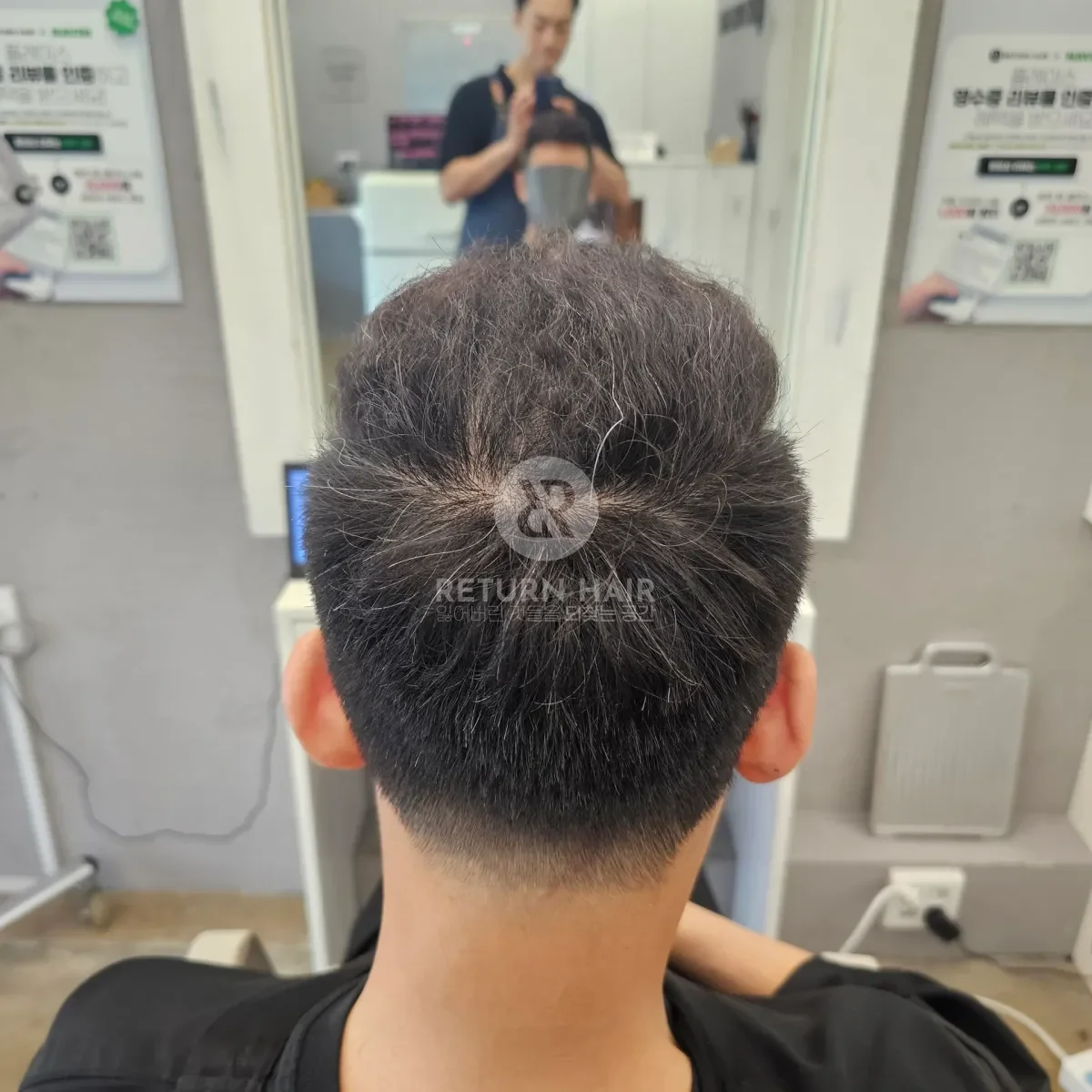 탈모 치트펌 파마 시술 후 결과 사진 6