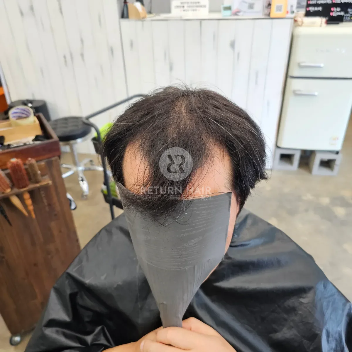 탈모 치트펌 파마 시술 전 사진 2