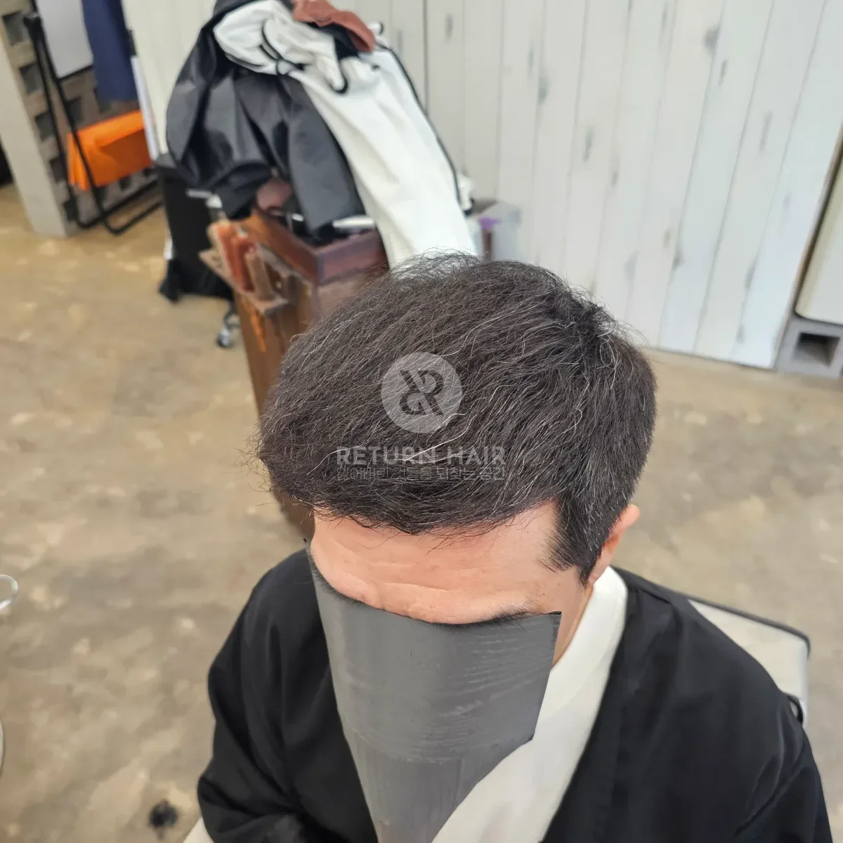 탈모 치트펌 파마 시술 후 결과 사진