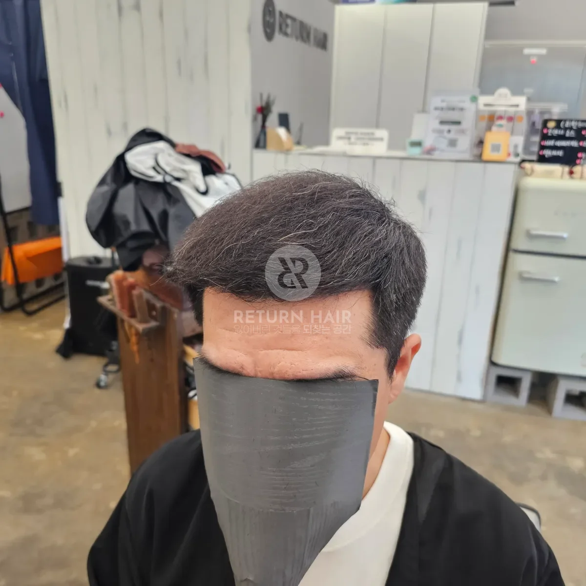 탈모 치트펌 파마 시술 후 결과 사진 2