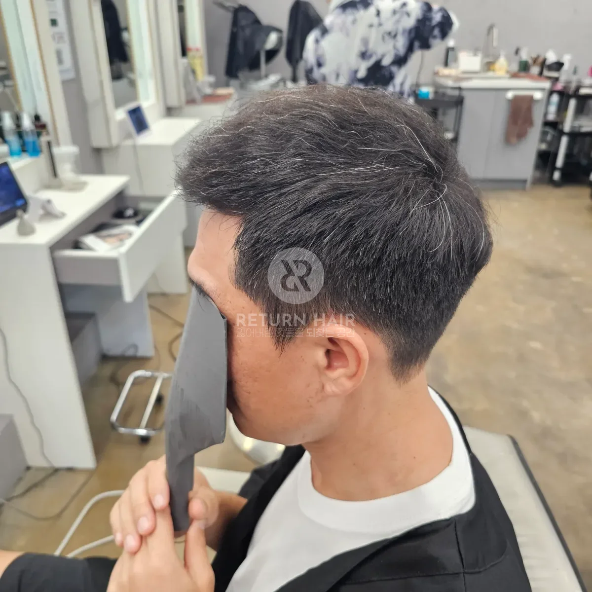 탈모 치트펌 파마 시술 후 결과 사진 4