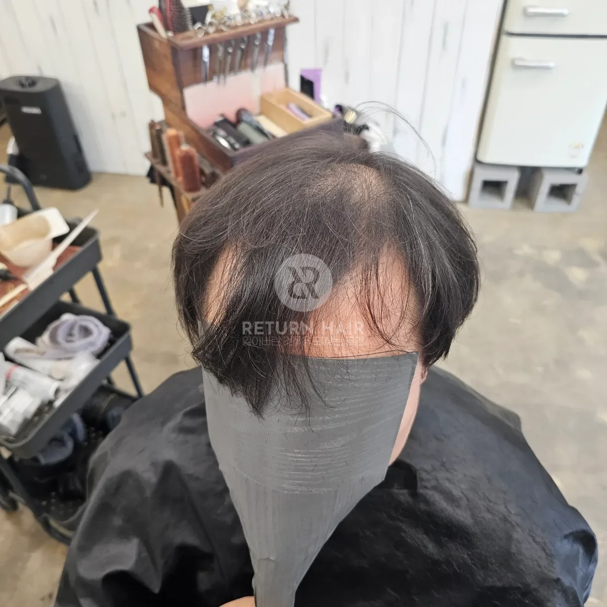 회춘펌 (뿌리볼륨 교정펌) 시술 전 사진