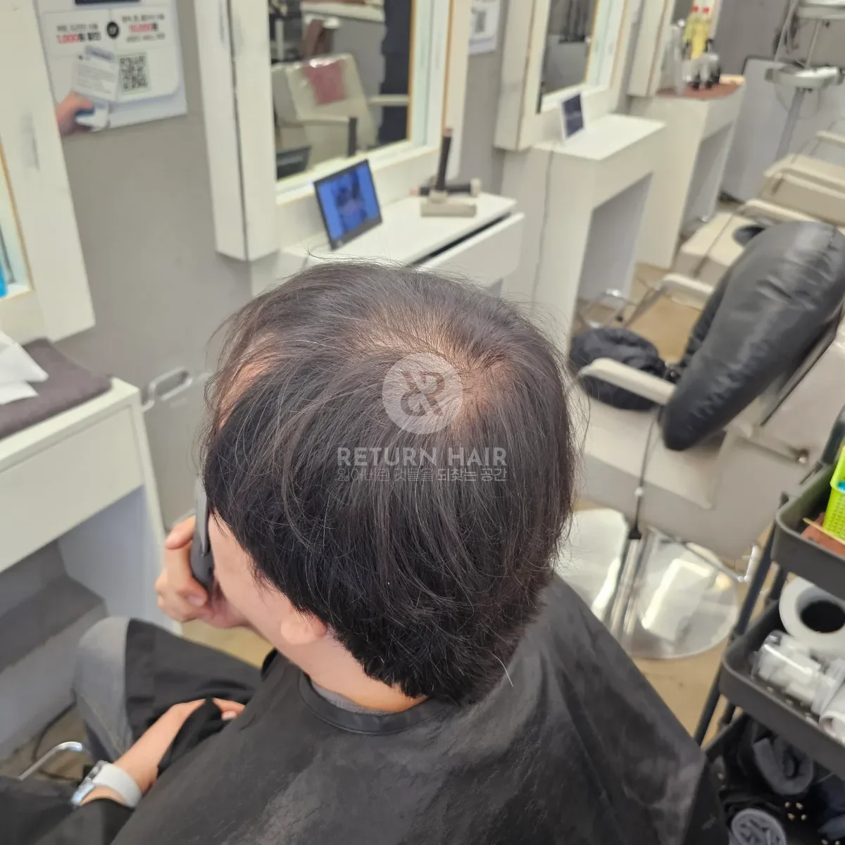 회춘펌 (뿌리볼륨 교정펌) 시술 전 사진 3