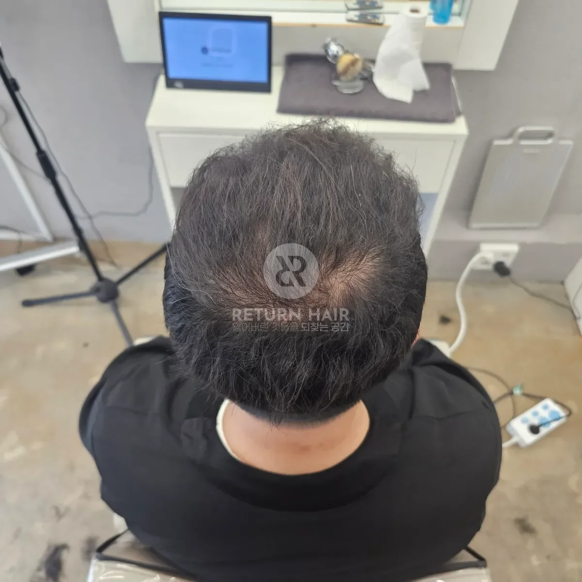 회춘펌 (뿌리볼륨 교정펌) 시술 후 결과 사진 1