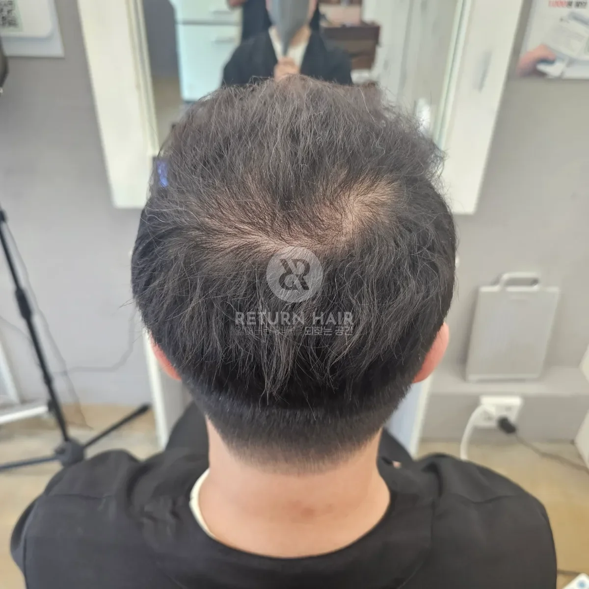 회춘펌 (뿌리볼륨 교정펌) 시술 후 결과 사진 2