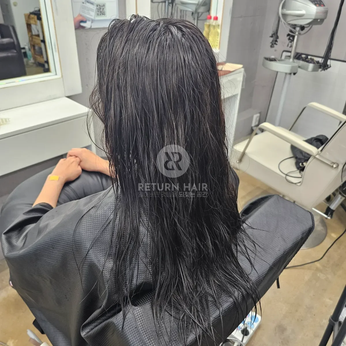 리턴 복구셋팅펌 시술 전 사진 4