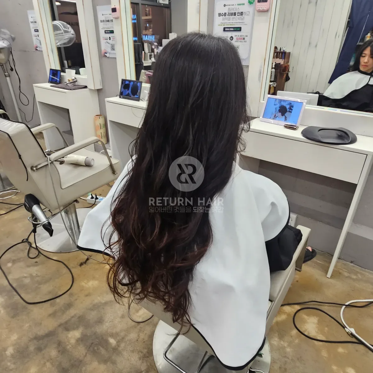 리턴 복구셋팅펌 시술 후 결과 사진 2