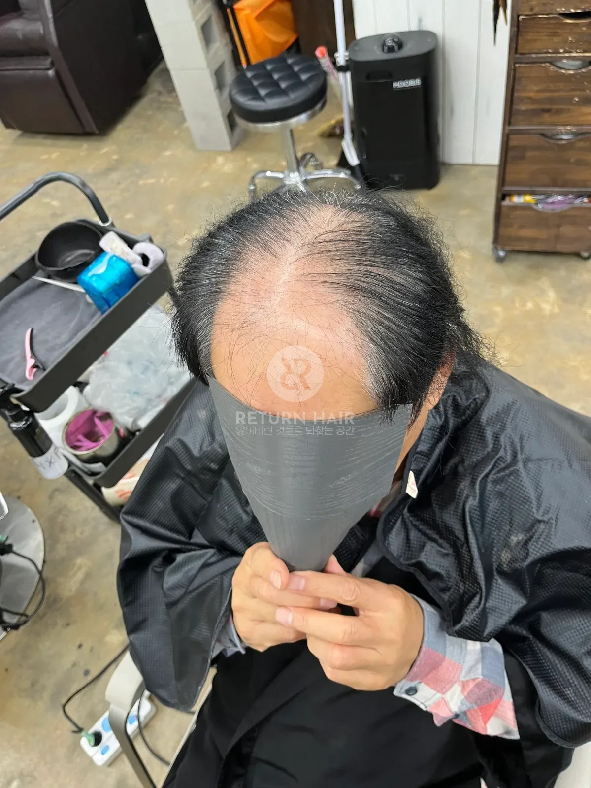 탈모 치트펌 파마 시술 전 사진