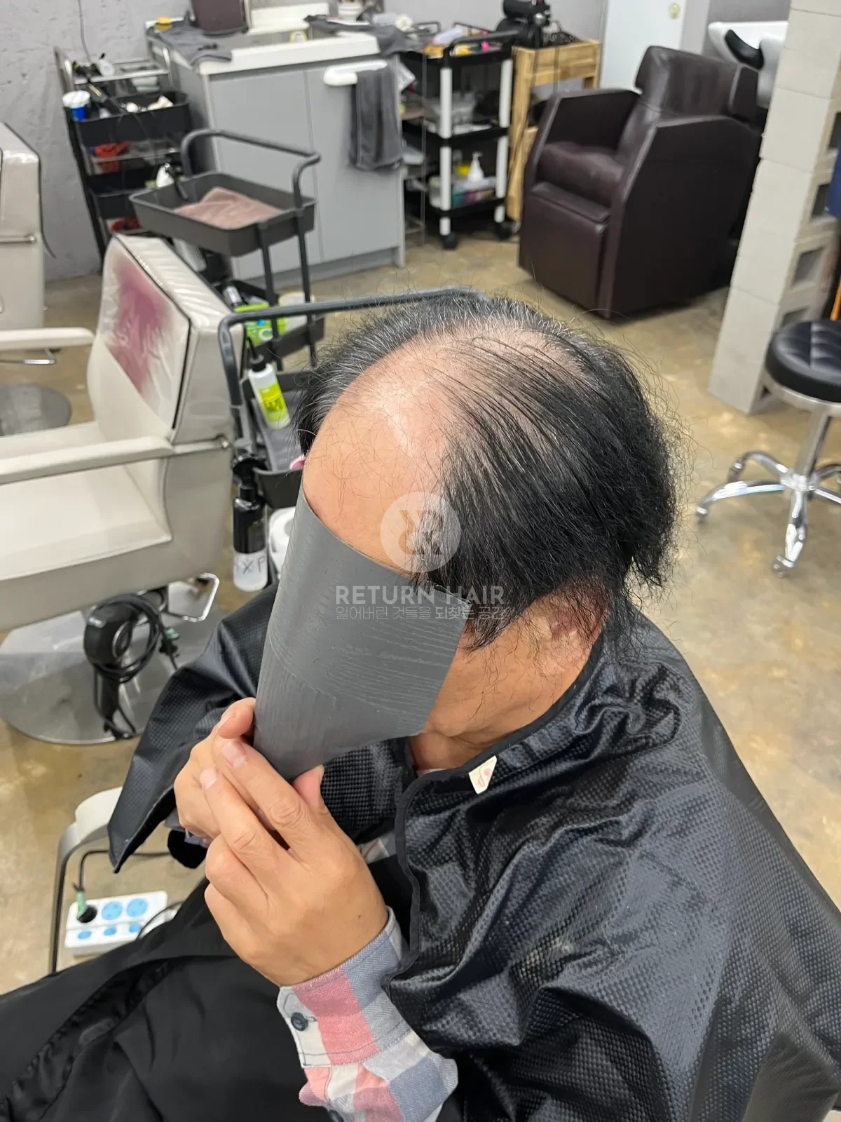 탈모 치트펌 파마 시술 전 사진 2