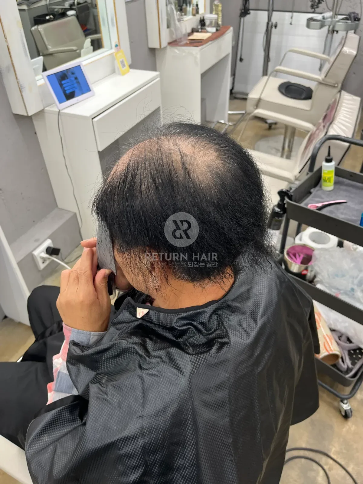 탈모 치트펌 파마 시술 전 사진 4