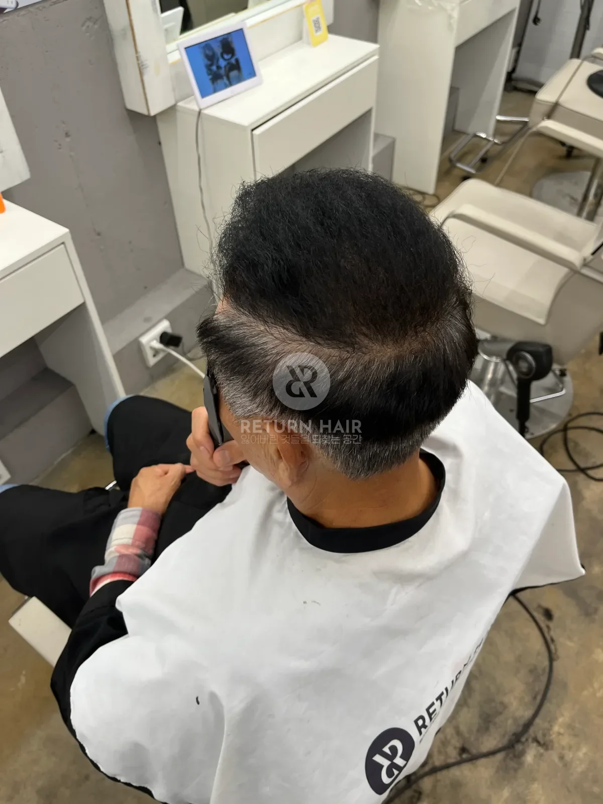 탈모 치트펌 파마 시술 후 결과 사진 2