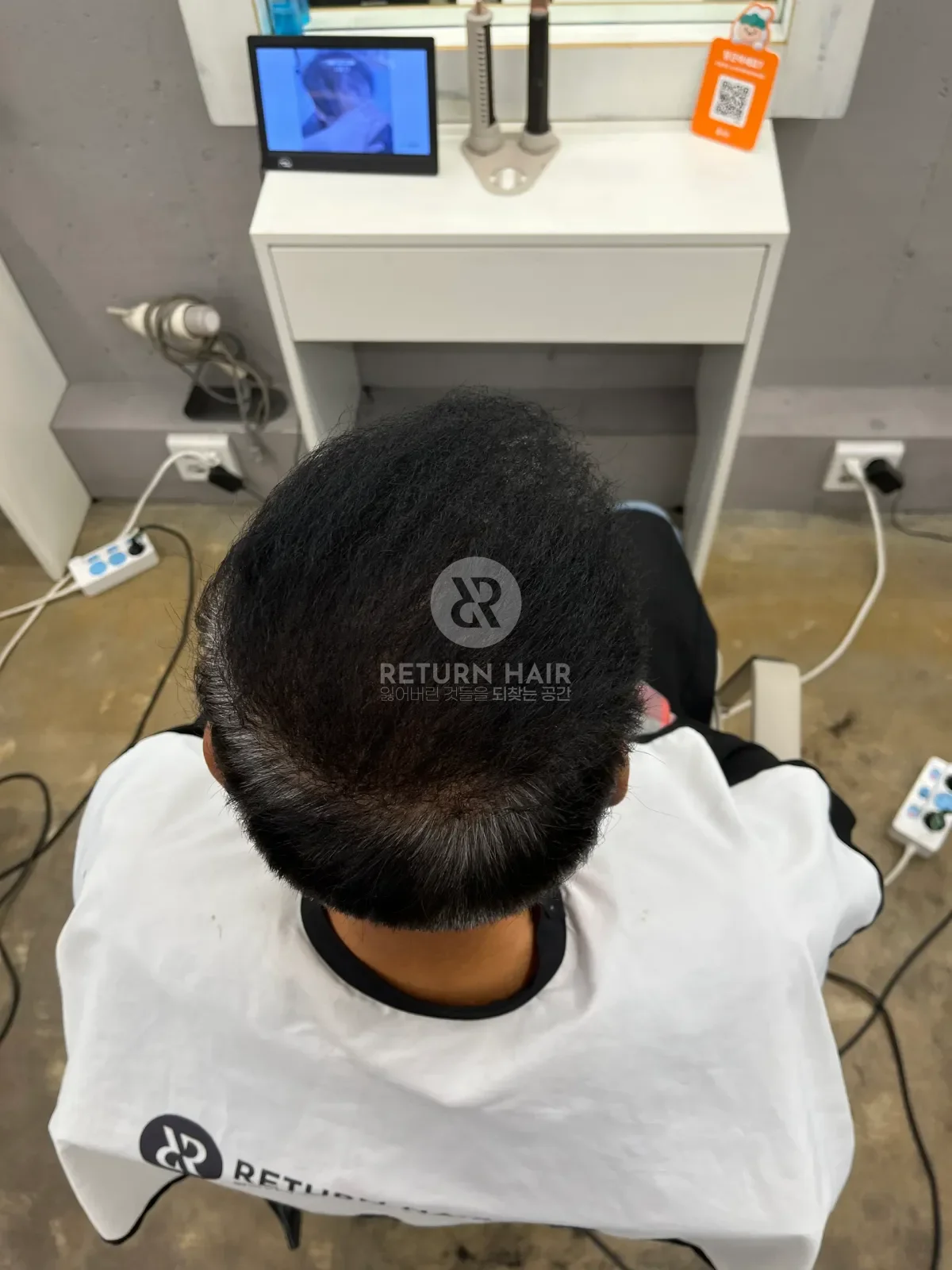 탈모 치트펌 파마 시술 후 결과 사진 4