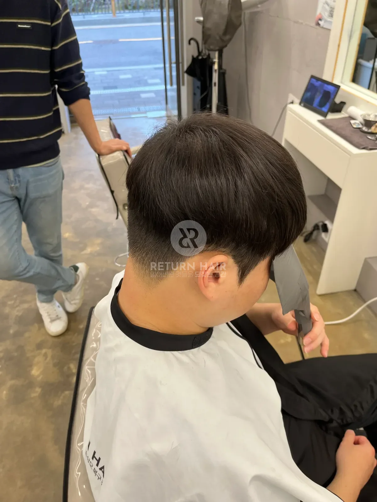 탈모 스프링매직 시술 후 결과 사진 5