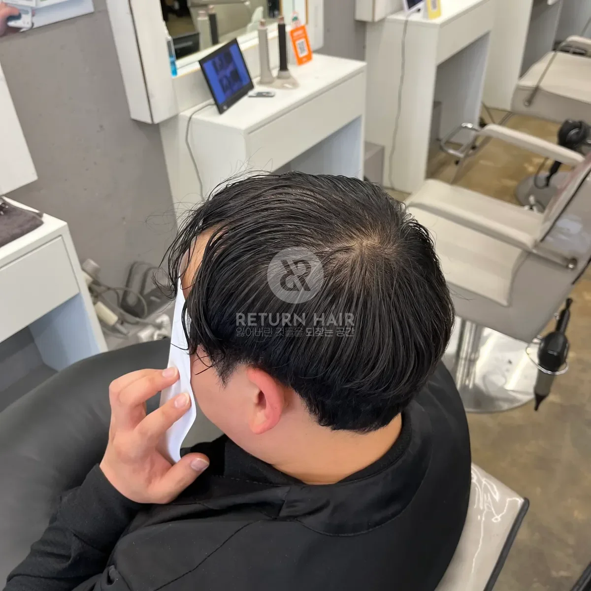 탈모 치트펌 파마 시술 전 사진 3