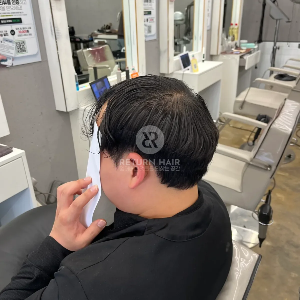 탈모 치트펌 파마 시술 전 사진 4