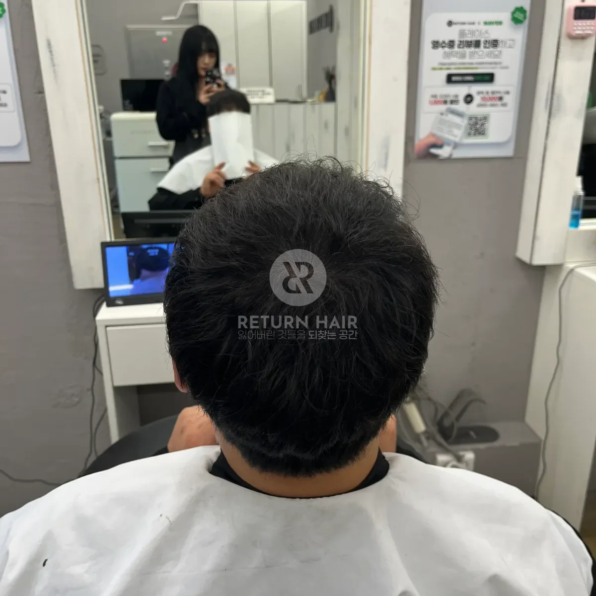 탈모 치트펌 파마 시술 후 결과 사진 5
