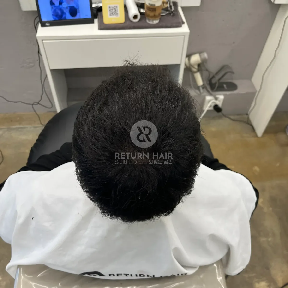 탈모 치트펌 파마 시술 후 결과 사진 6