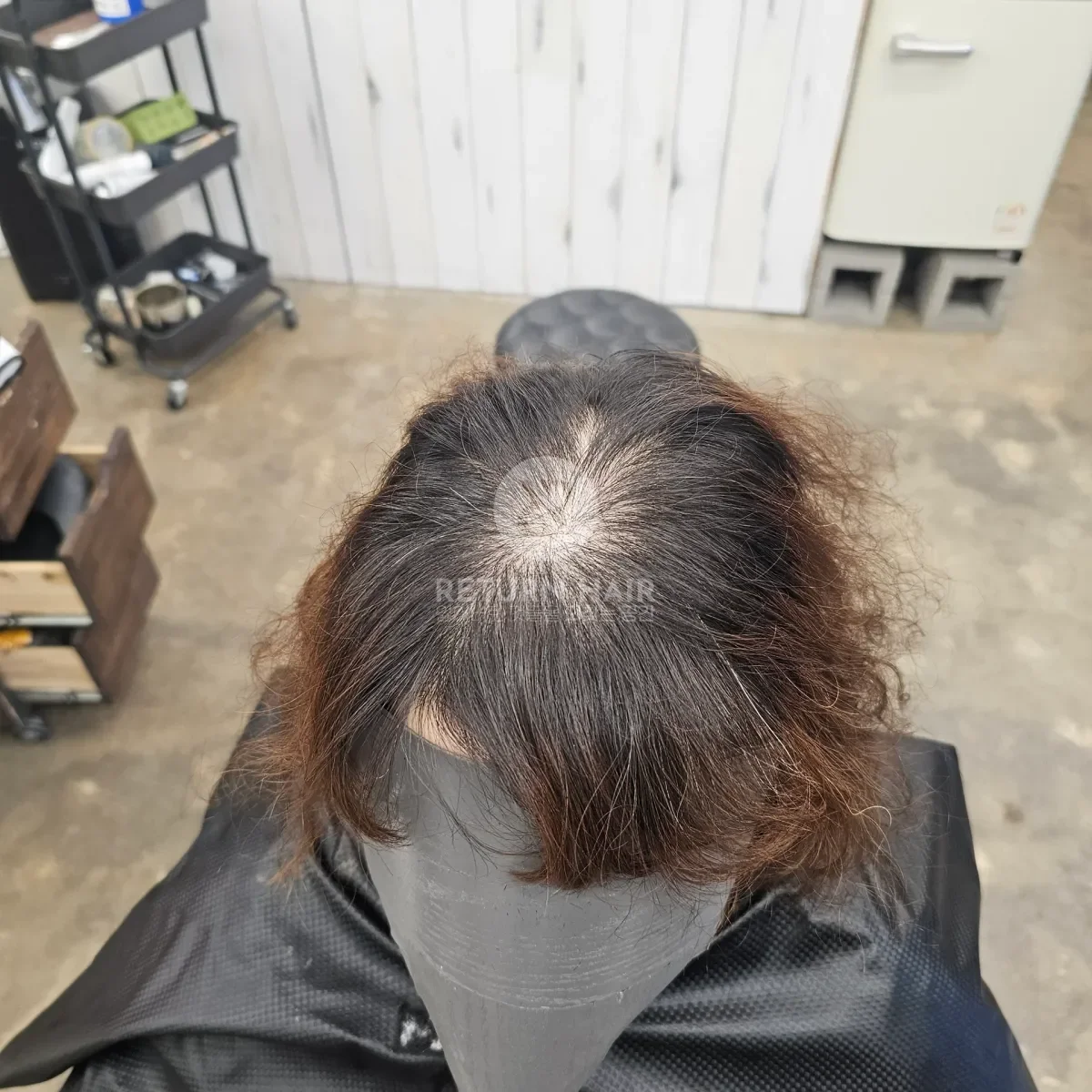 두피페인팅 (치트염색) 시술 전 사진