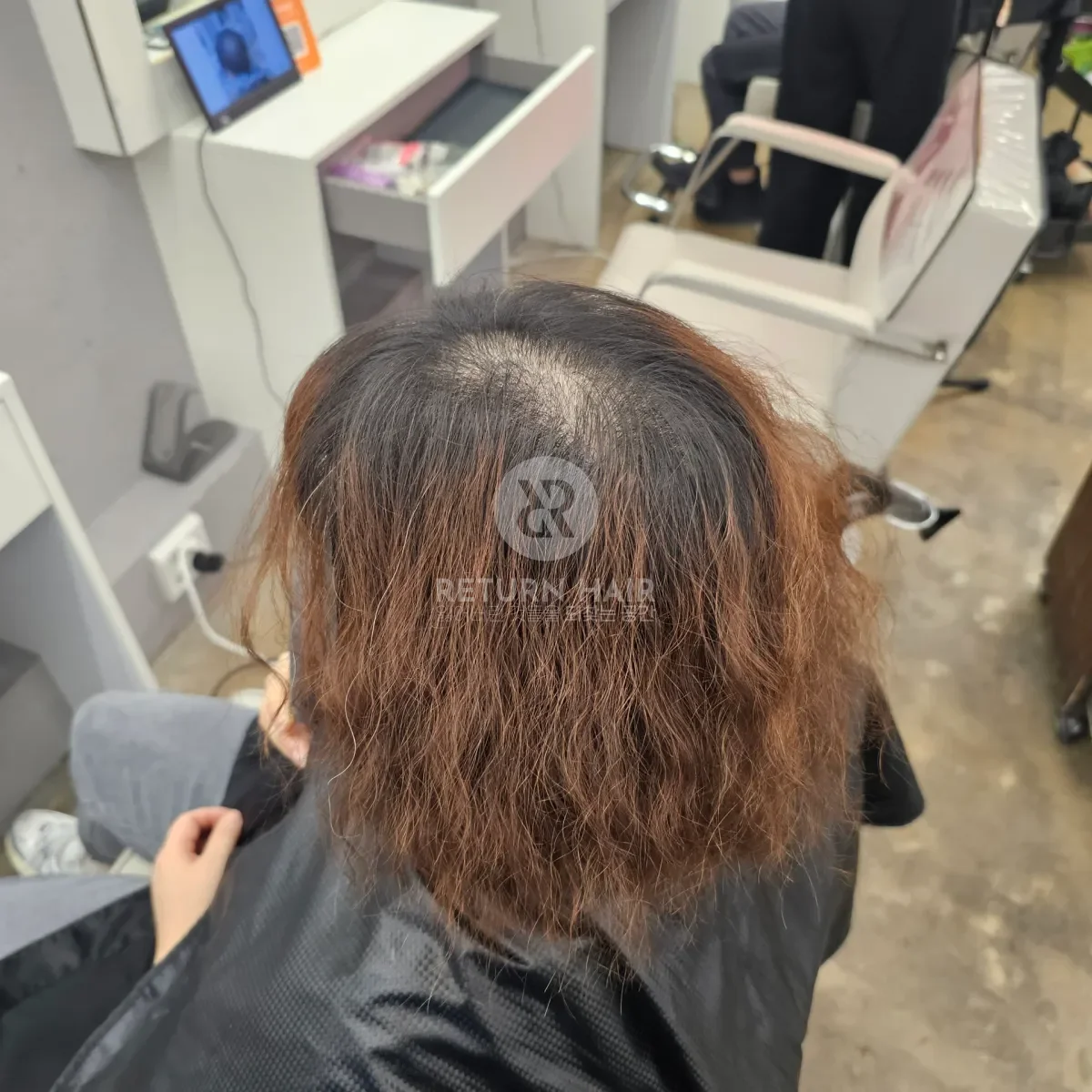 두피페인팅 (치트염색) 시술 전 사진 3