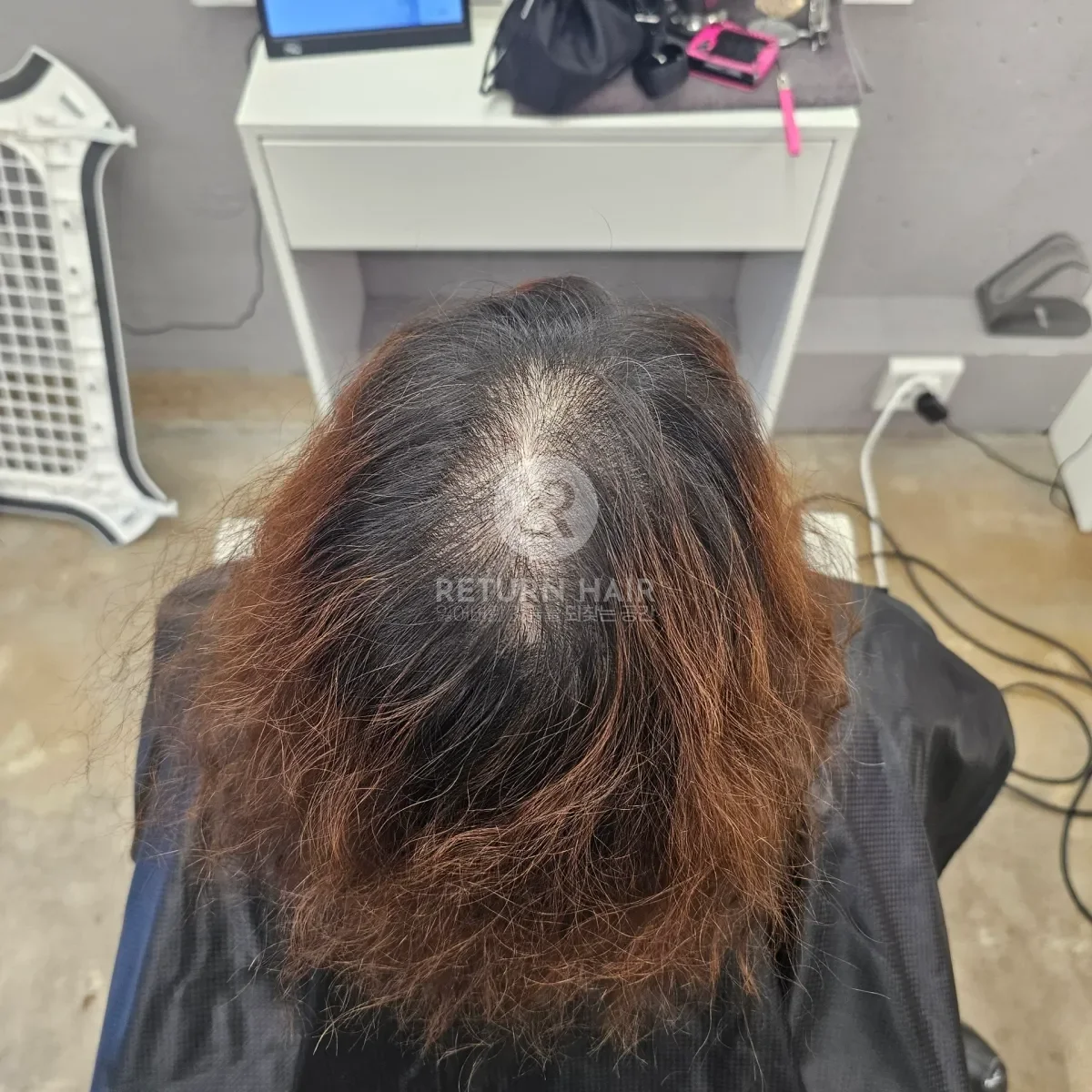 두피페인팅 (치트염색) 시술 전 사진 5