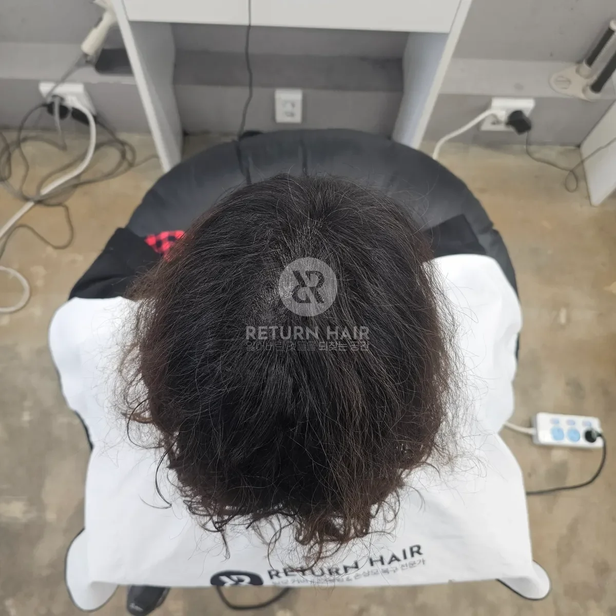 두피페인팅 (치트염색) 시술 후 결과 사진 6