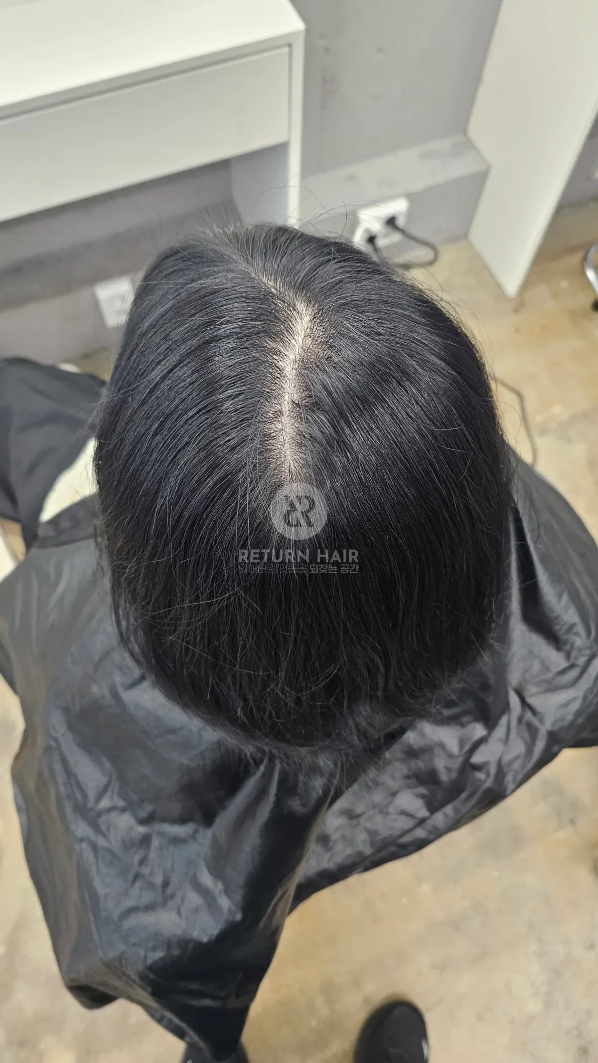 회춘펌 (뿌리볼륨 교정펌) 시술 전 사진