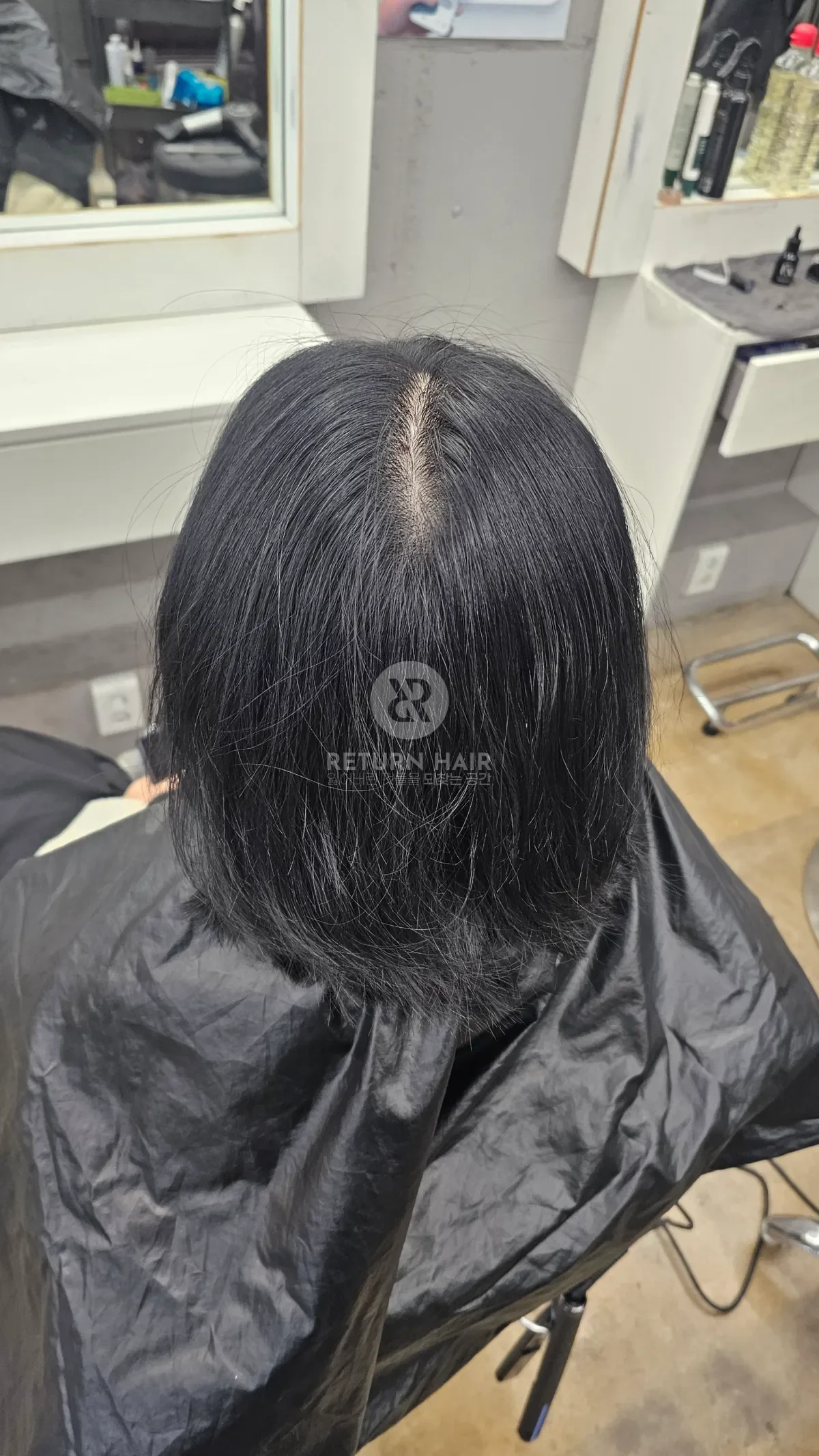 회춘펌 (뿌리볼륨 교정펌) 시술 전 사진 2