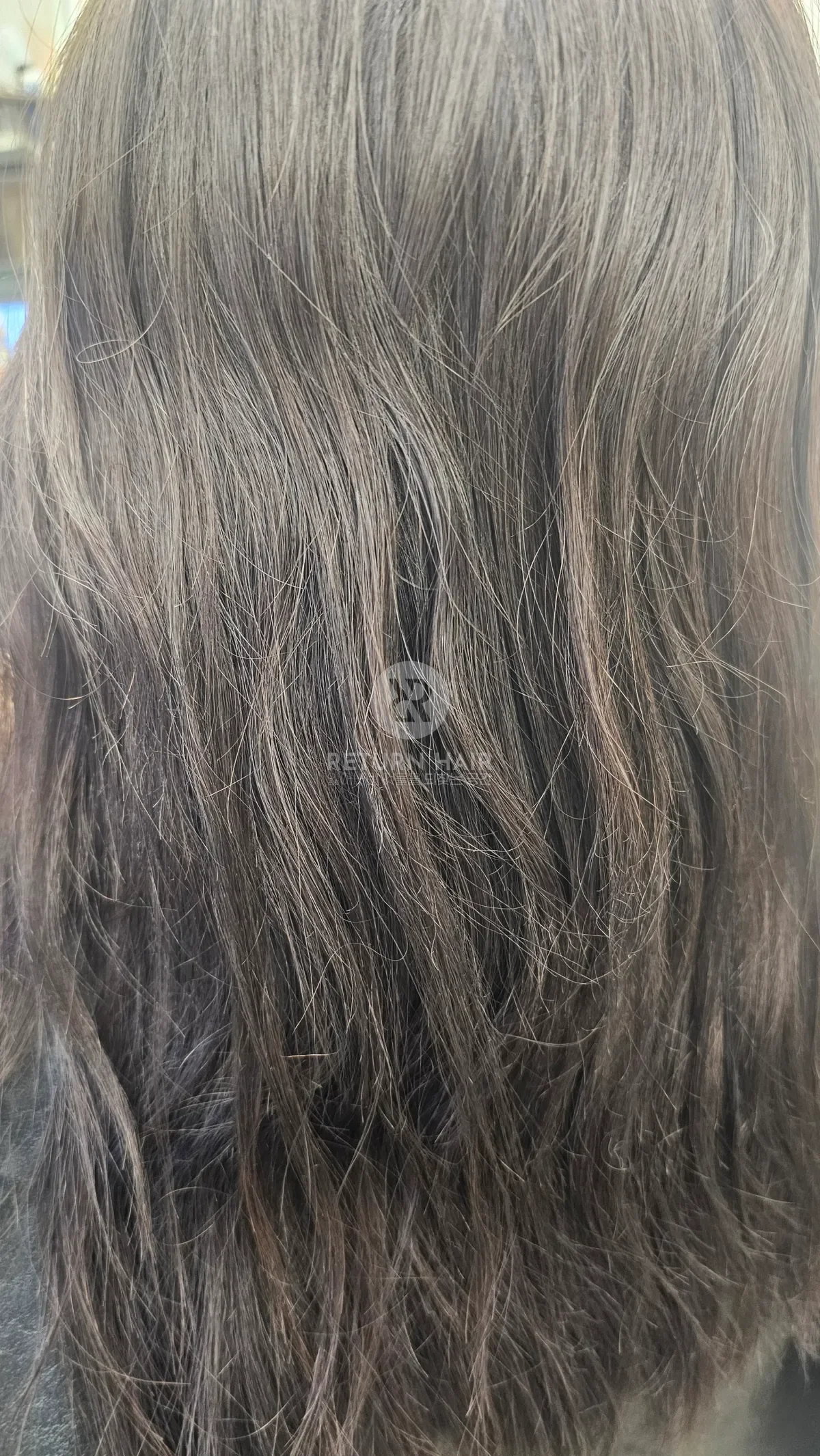 리턴 복구매직 시술 전 사진