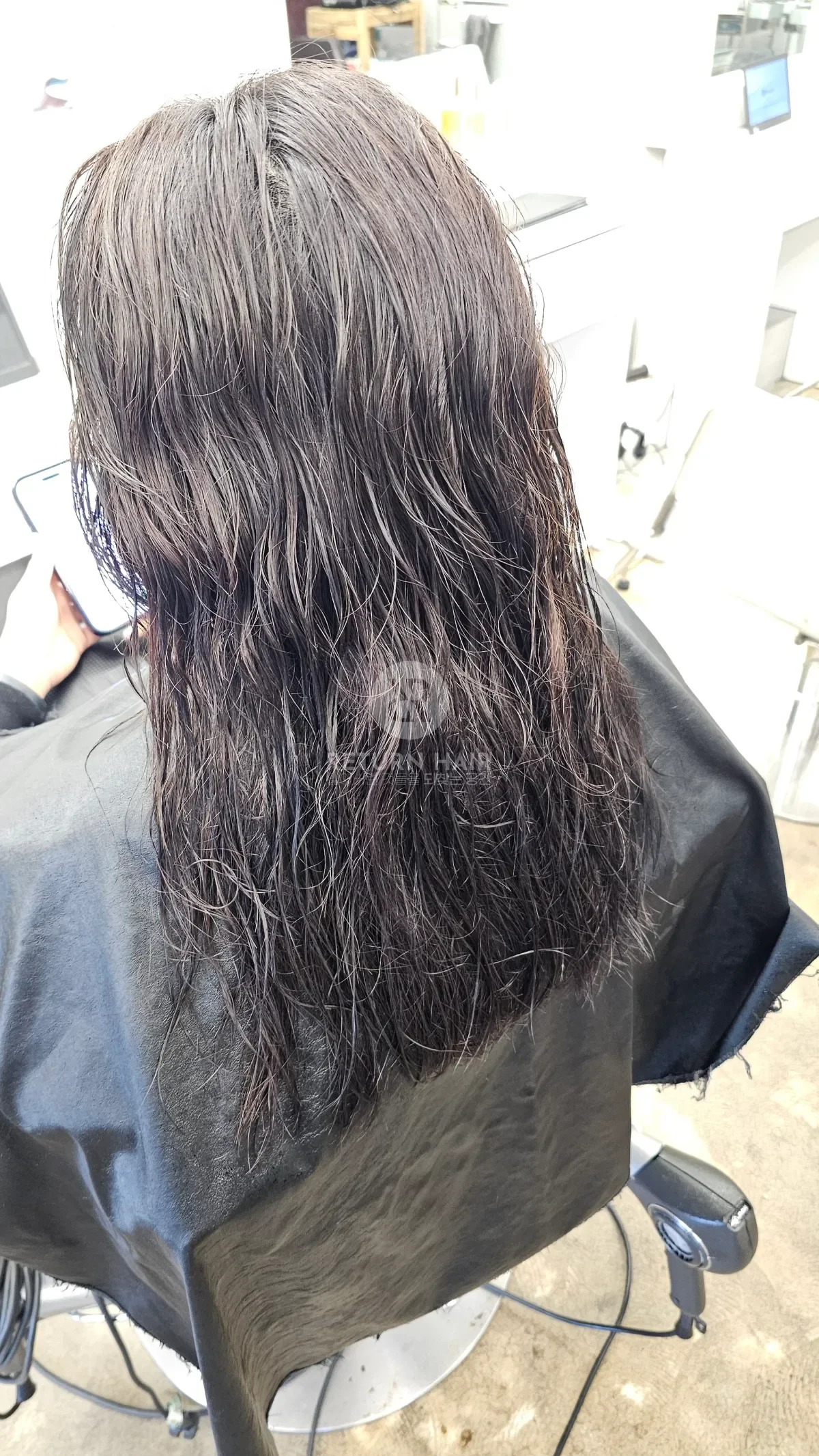 리턴 복구매직 시술 전 사진 2