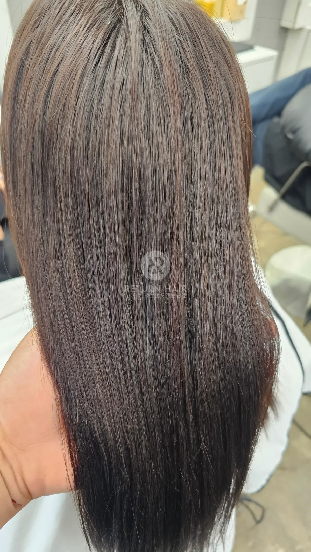 리턴 복구매직 시술 후 결과 사진