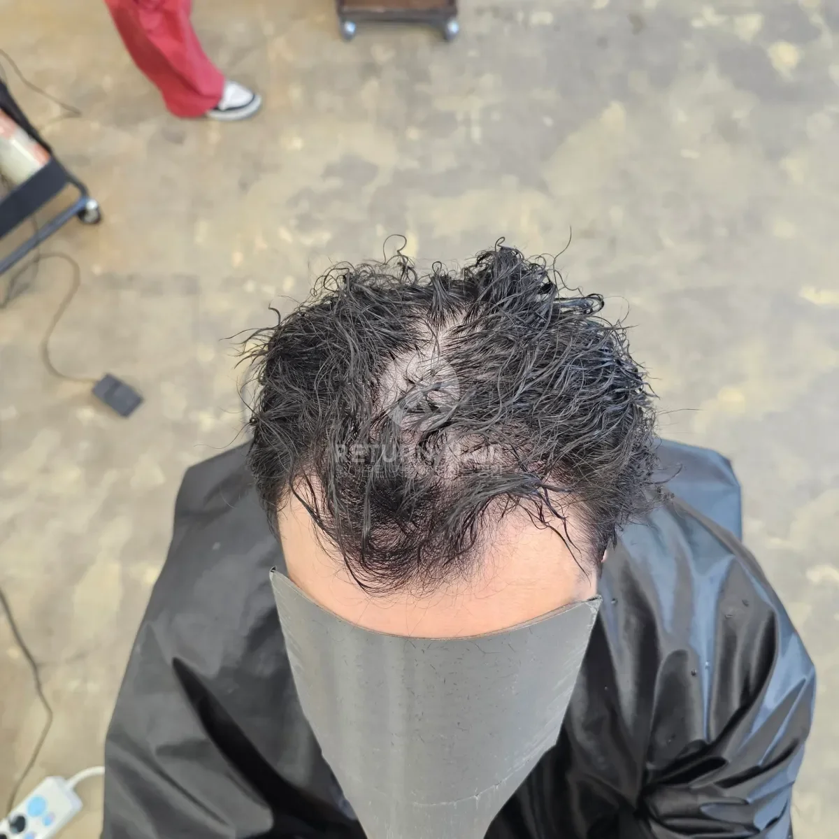 두피페인팅 (치트염색) 시술 전 사진