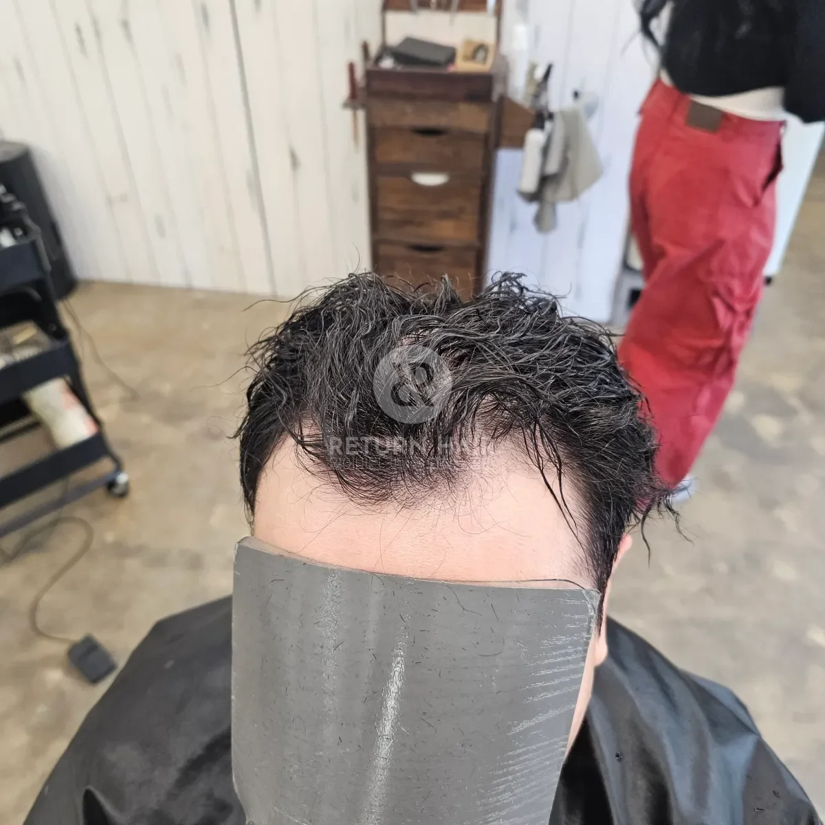 두피페인팅 (치트염색) 시술 전 사진 2