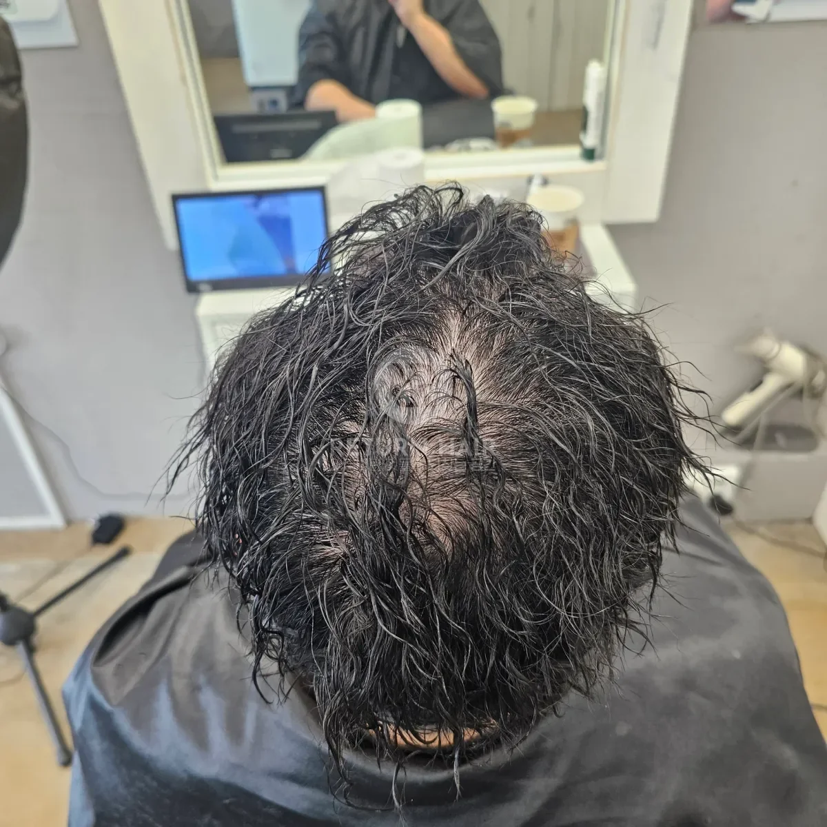 두피페인팅 (치트염색) 시술 전 사진 4