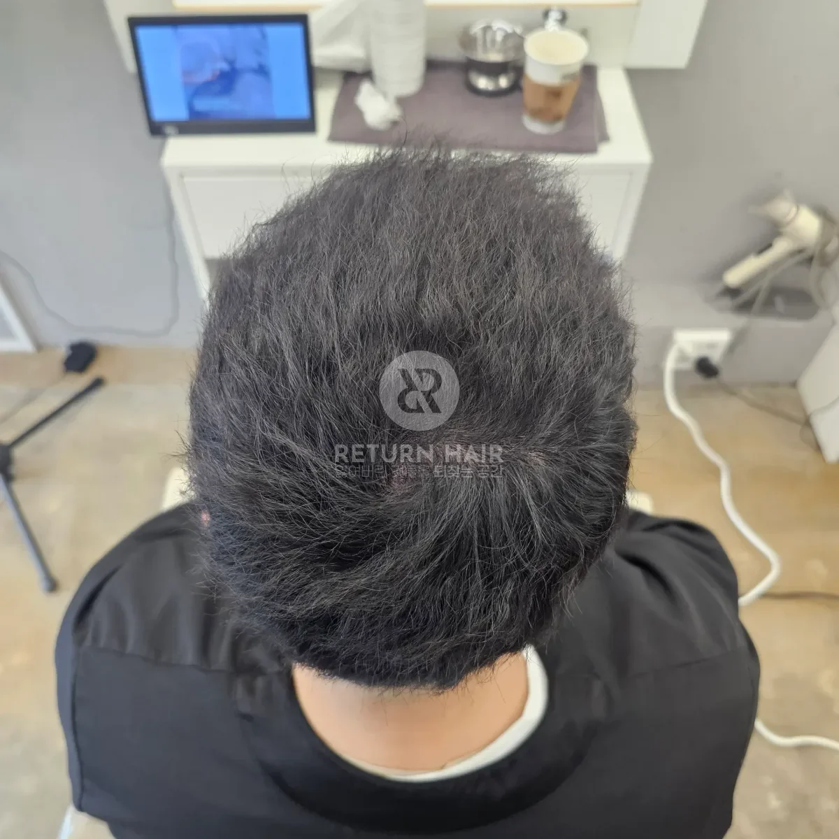 두피페인팅 (치트염색) 시술 후 결과 사진 6