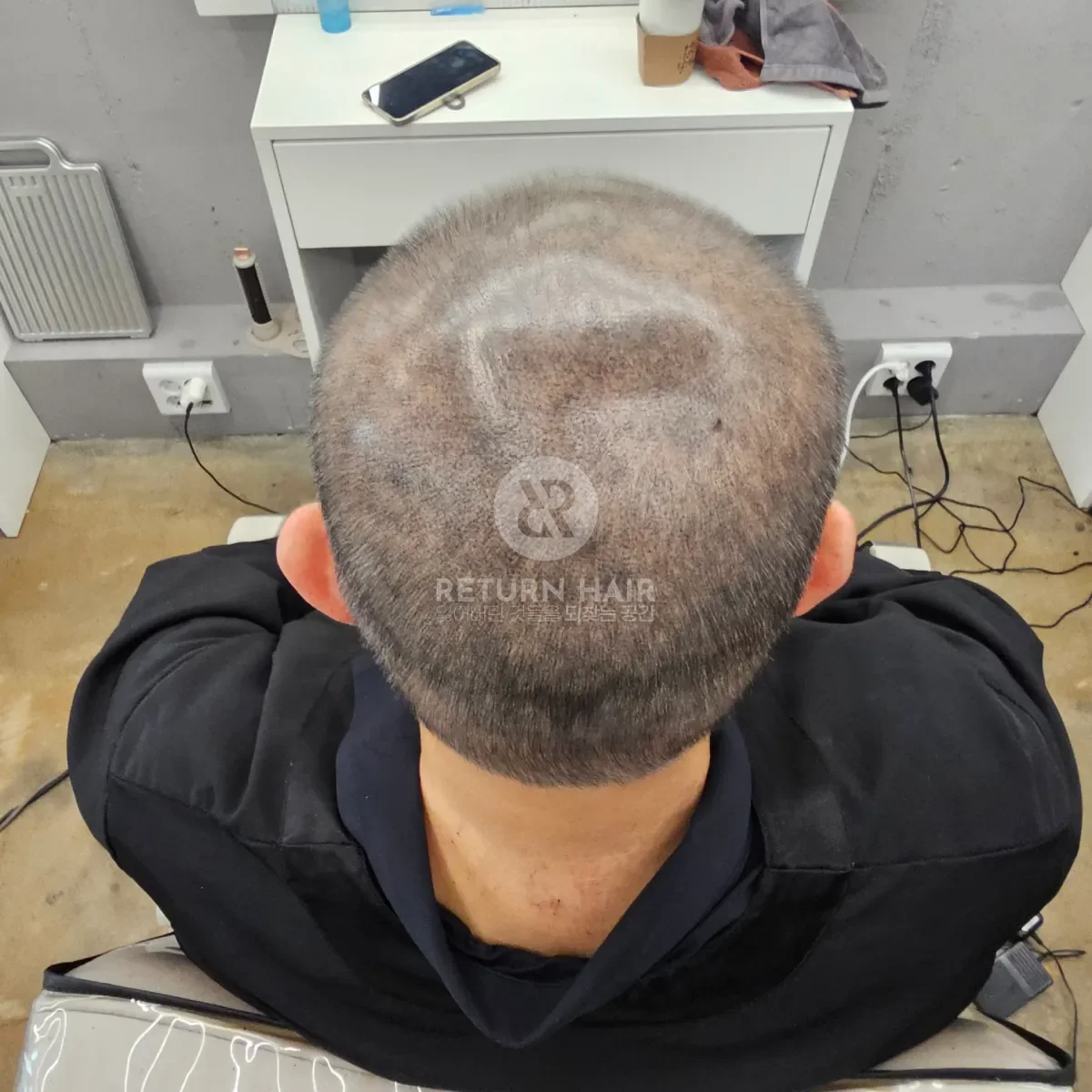 두피페인팅 (치트염색) 시술 후 결과 사진