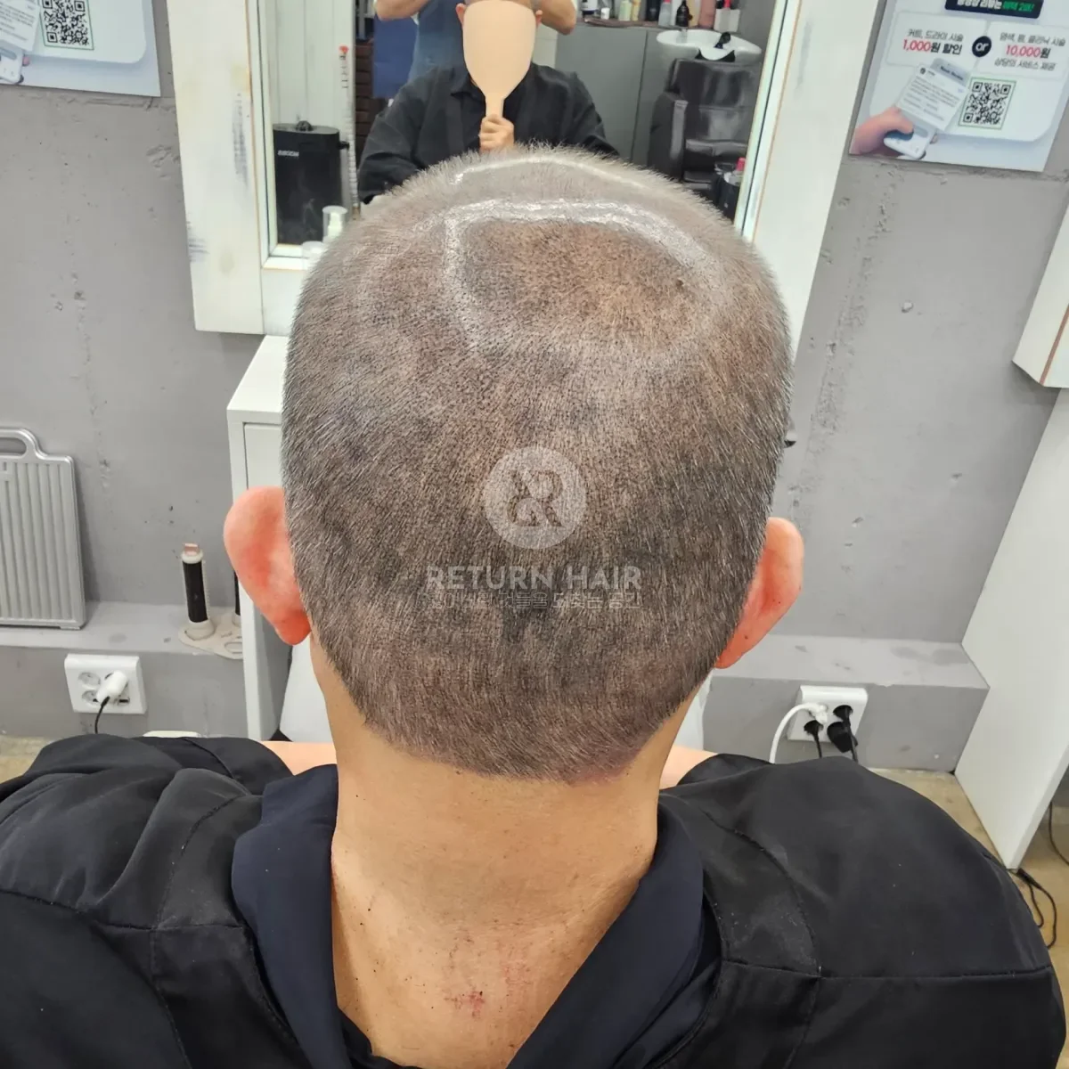 두피페인팅 (치트염색) 시술 후 결과 사진 2