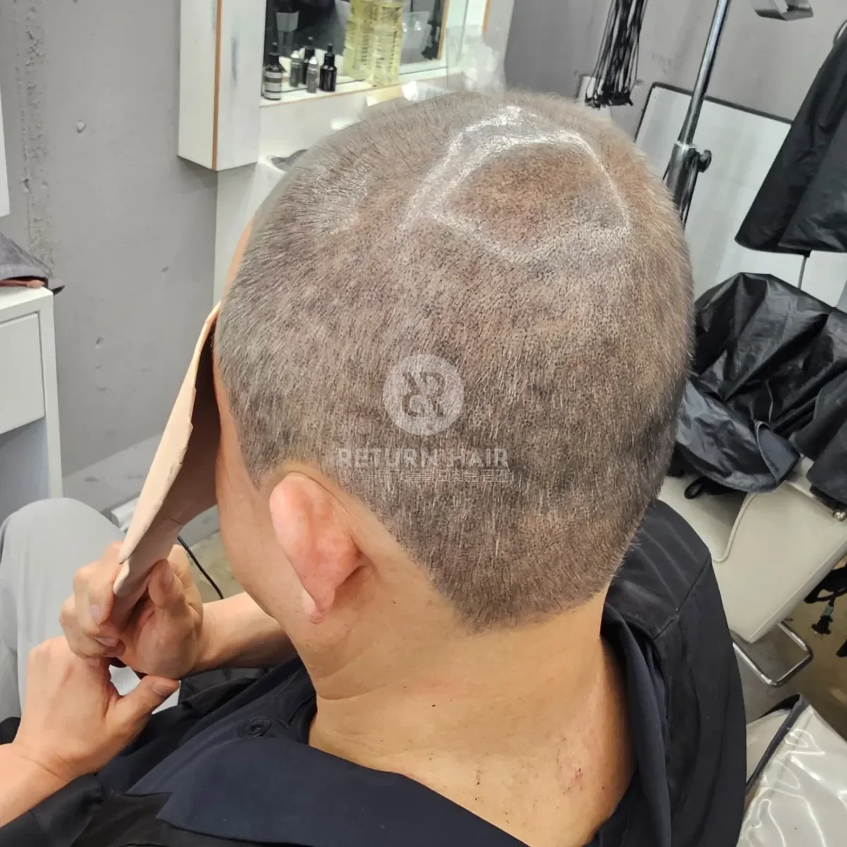 두피페인팅 (치트염색) 시술 후 결과 사진 3