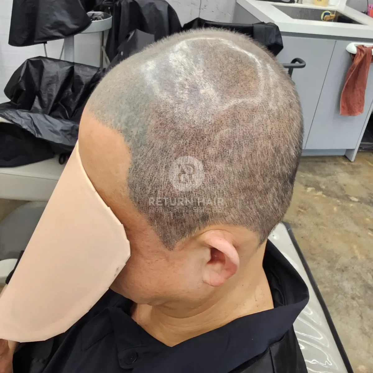 두피페인팅 (치트염색) 시술 후 결과 사진 4