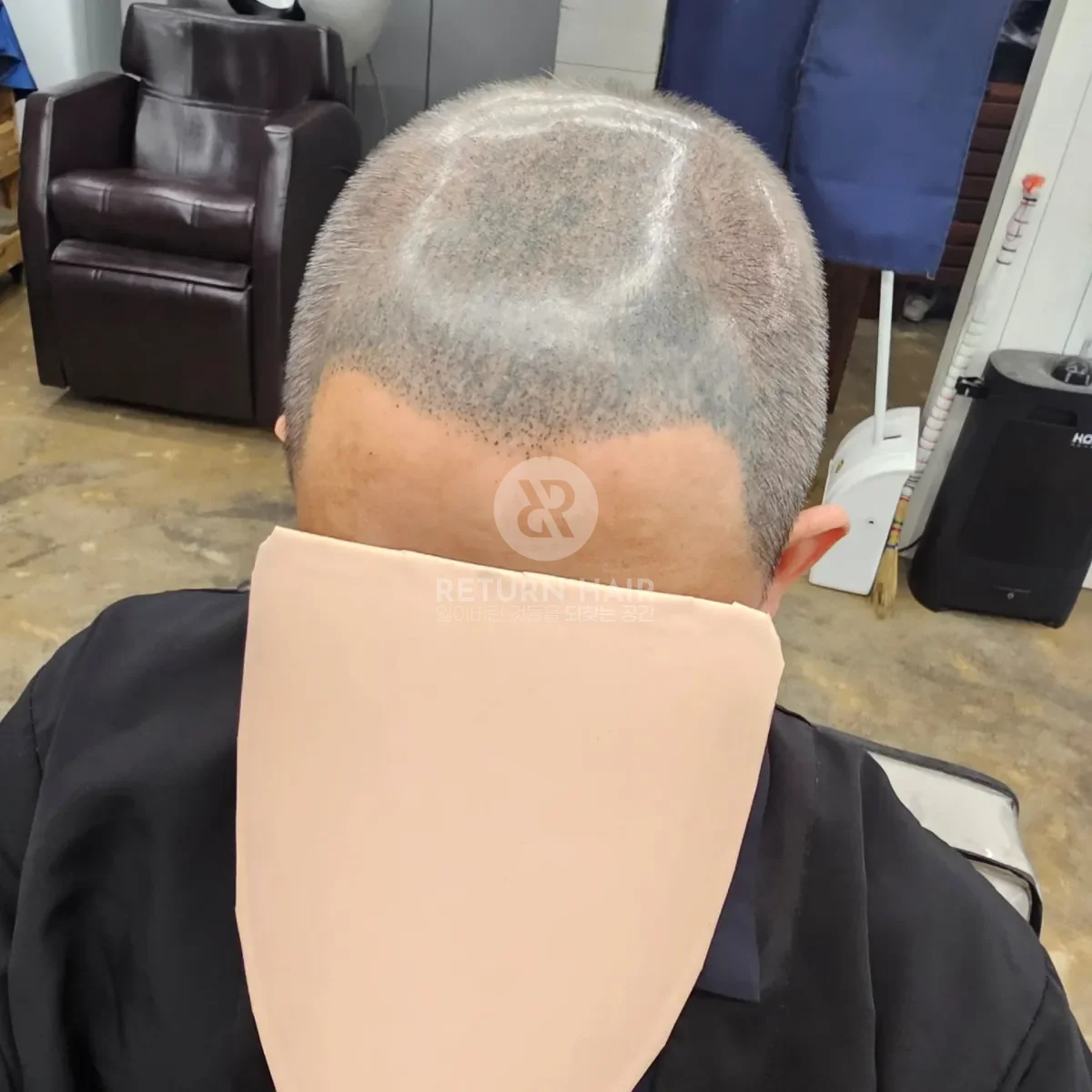 두피페인팅 (치트염색) 시술 후 결과 사진 5