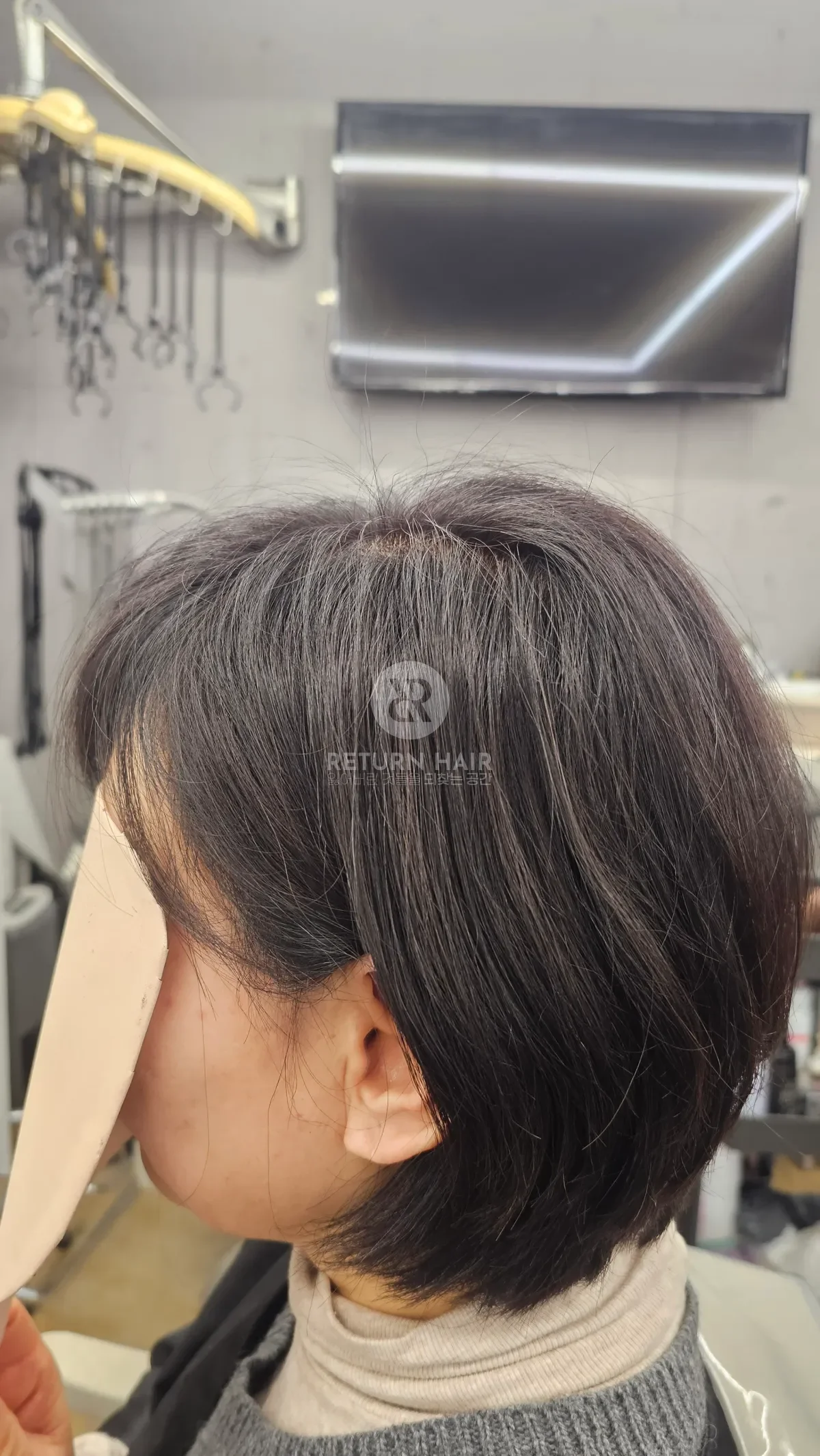 볼륨업 뿌리염색 시술 전 사진 3