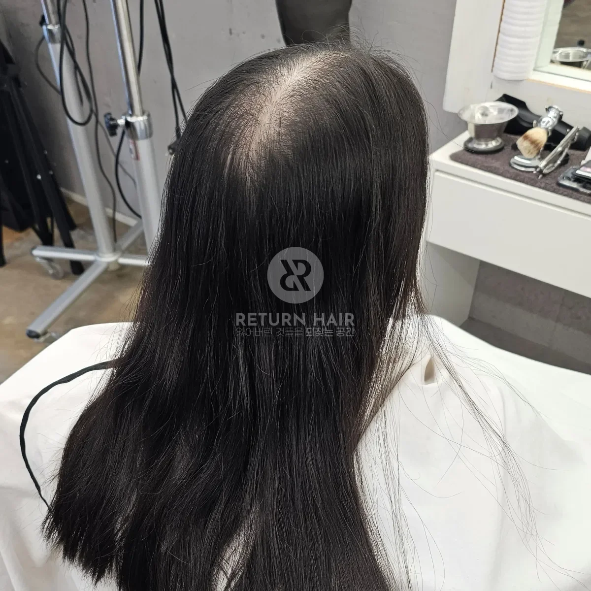 입춘 테라피 (플라즈마 PDRN) 시술 전 사진 1