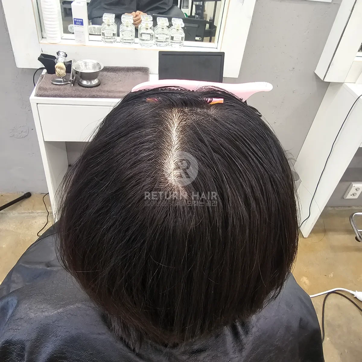 회춘펌 (뿌리볼륨 교정펌) 시술 전 사진