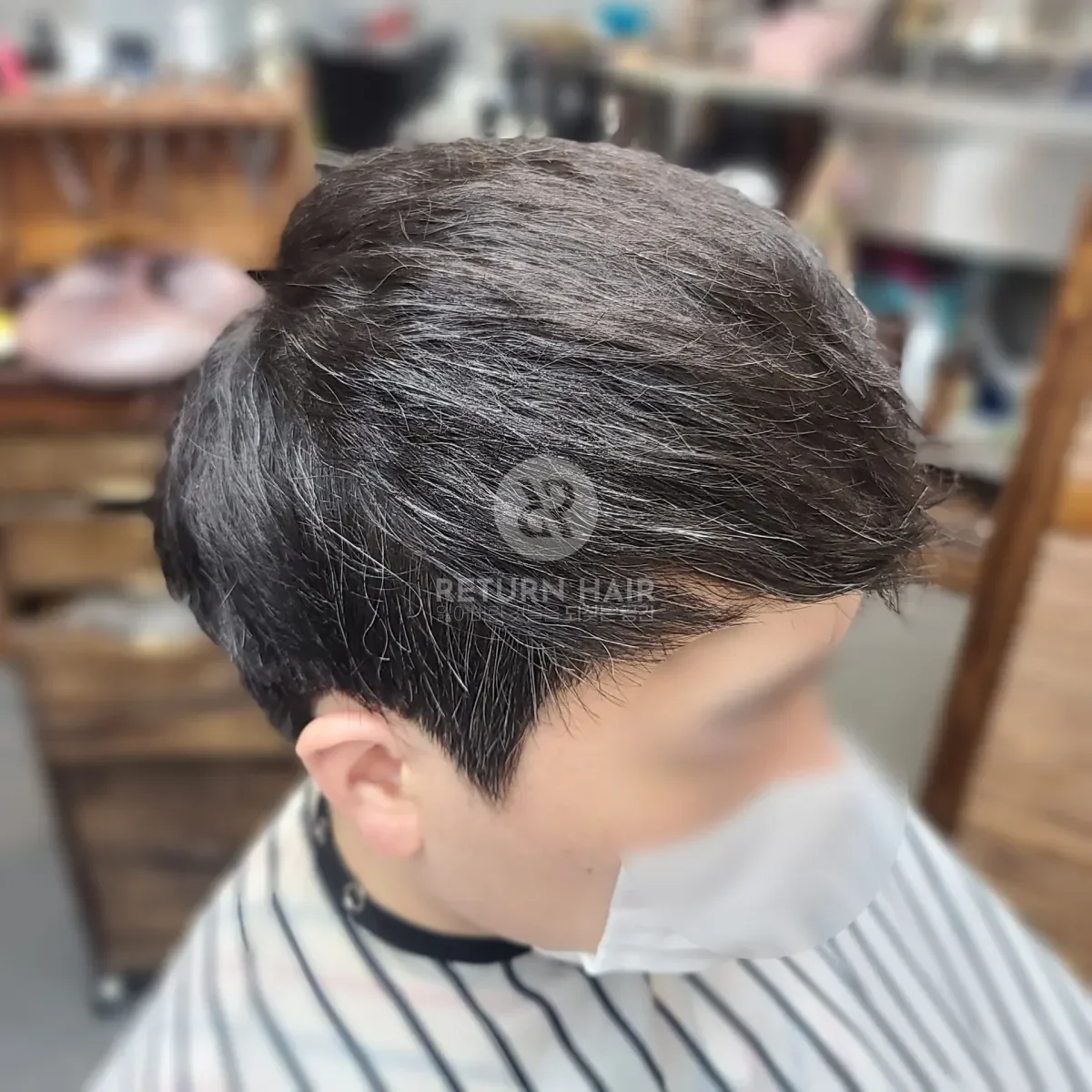탈모 치트펌 파마 시술 후 결과 사진