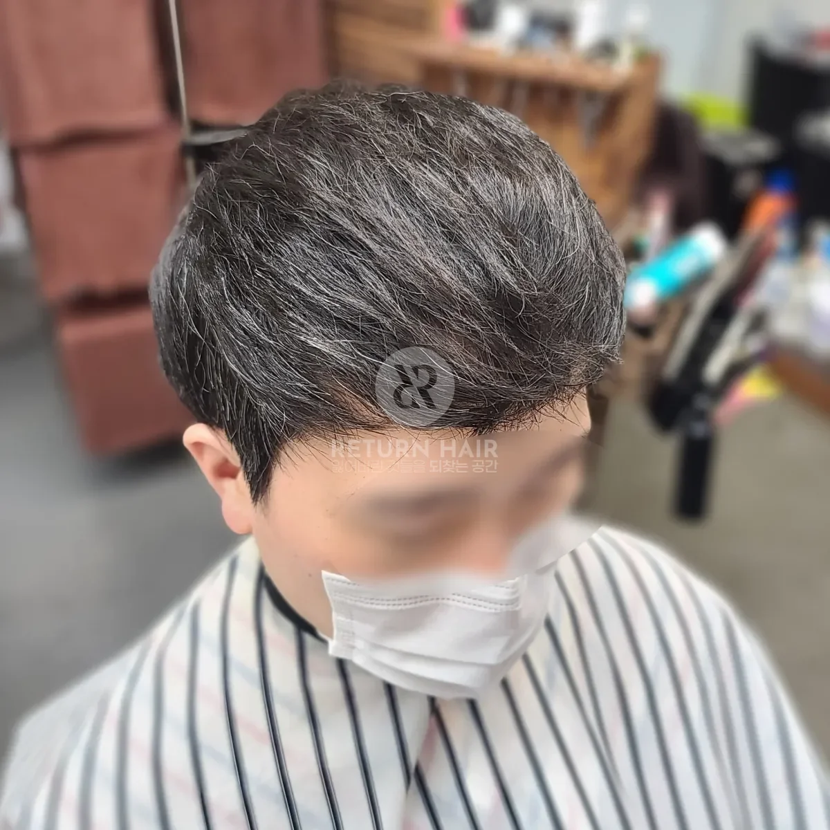 탈모 치트펌 파마 시술 후 결과 사진 2