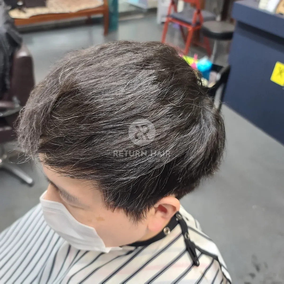 탈모 치트펌 파마 시술 후 결과 사진 3
