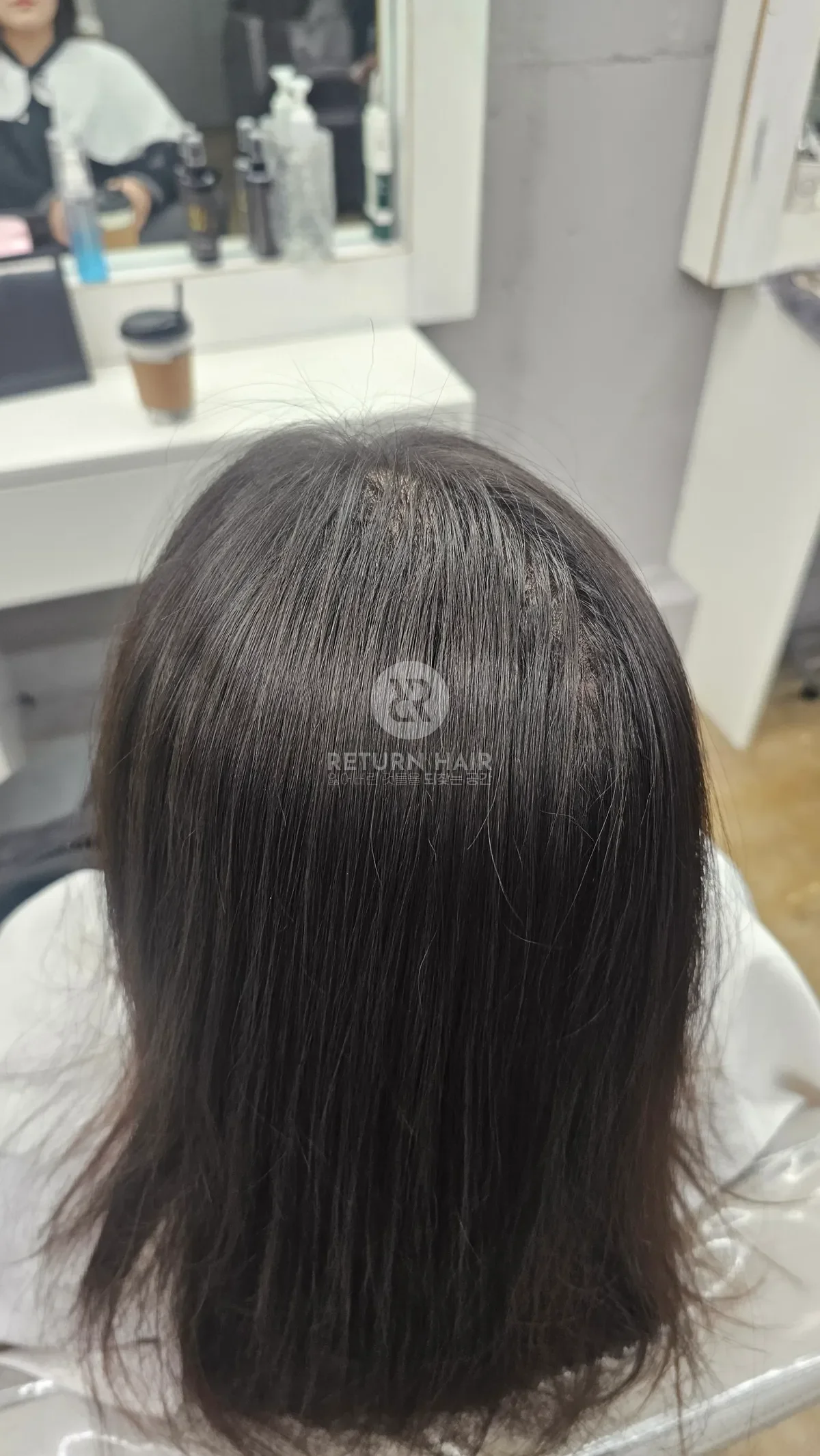 회춘펌 (뿌리볼륨 교정펌) 시술 후 결과 사진 5
