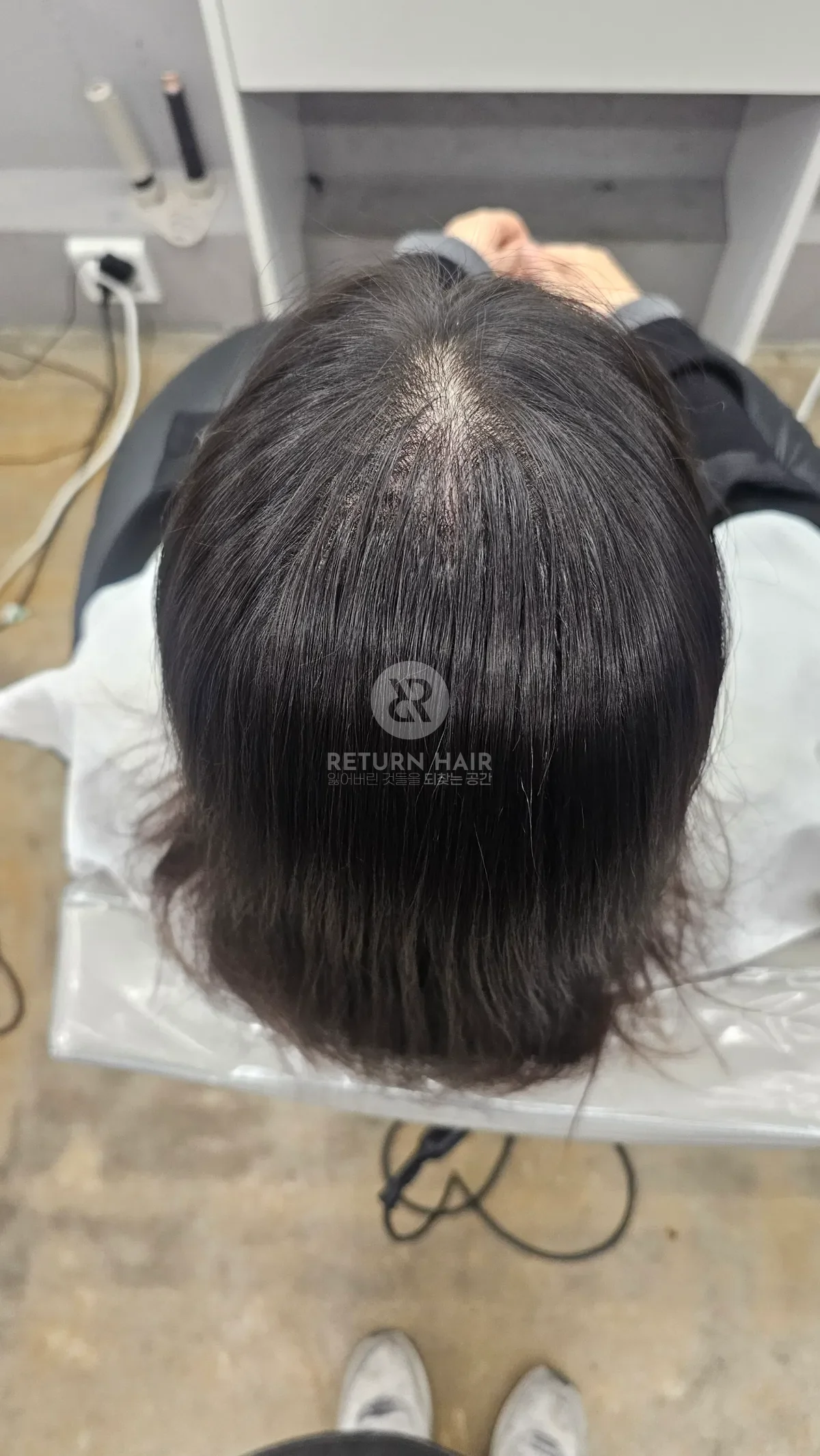 회춘펌 (뿌리볼륨 교정펌) 시술 후 결과 사진 6