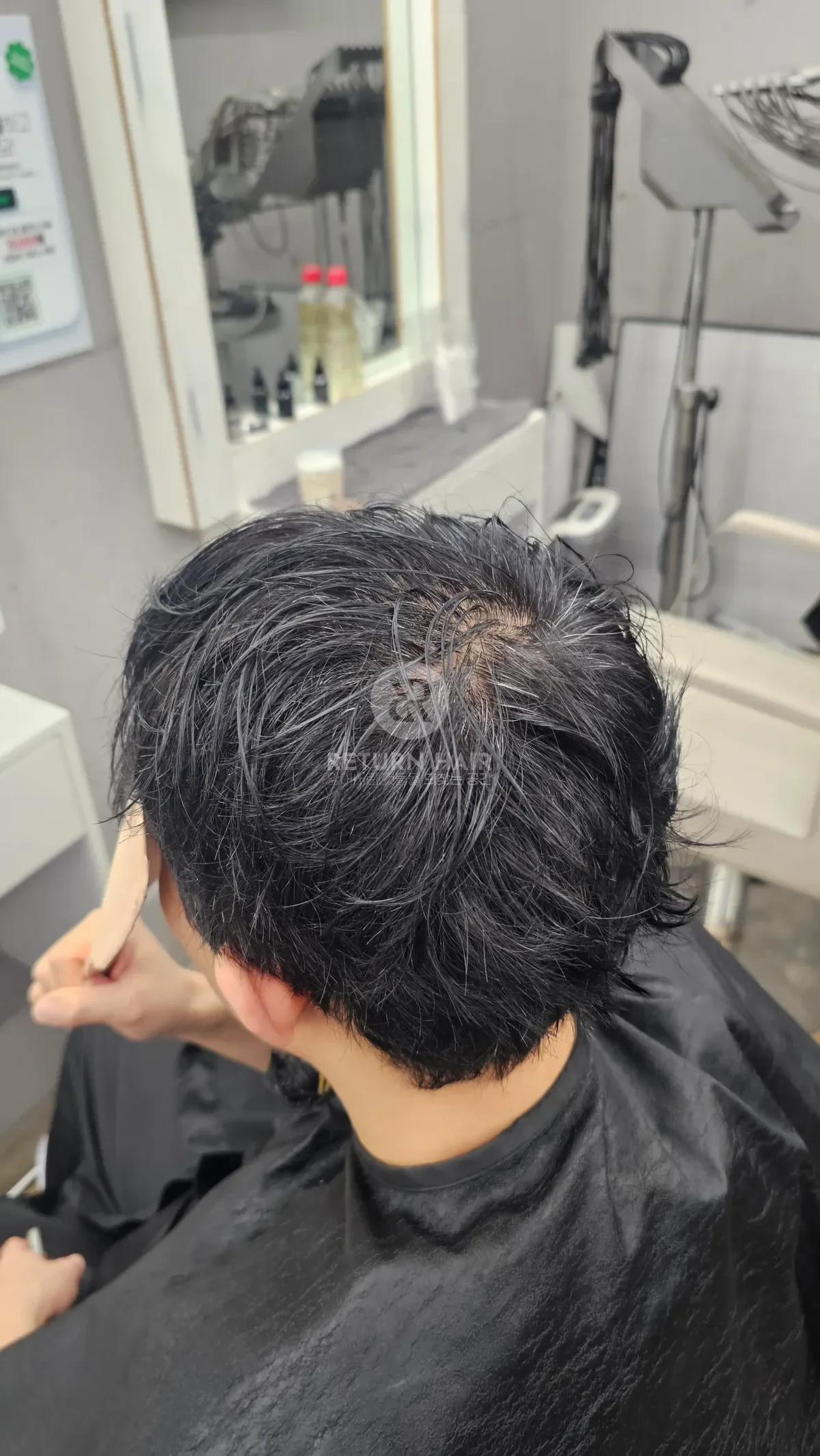 탈모 치트펌 파마 시술 전 사진