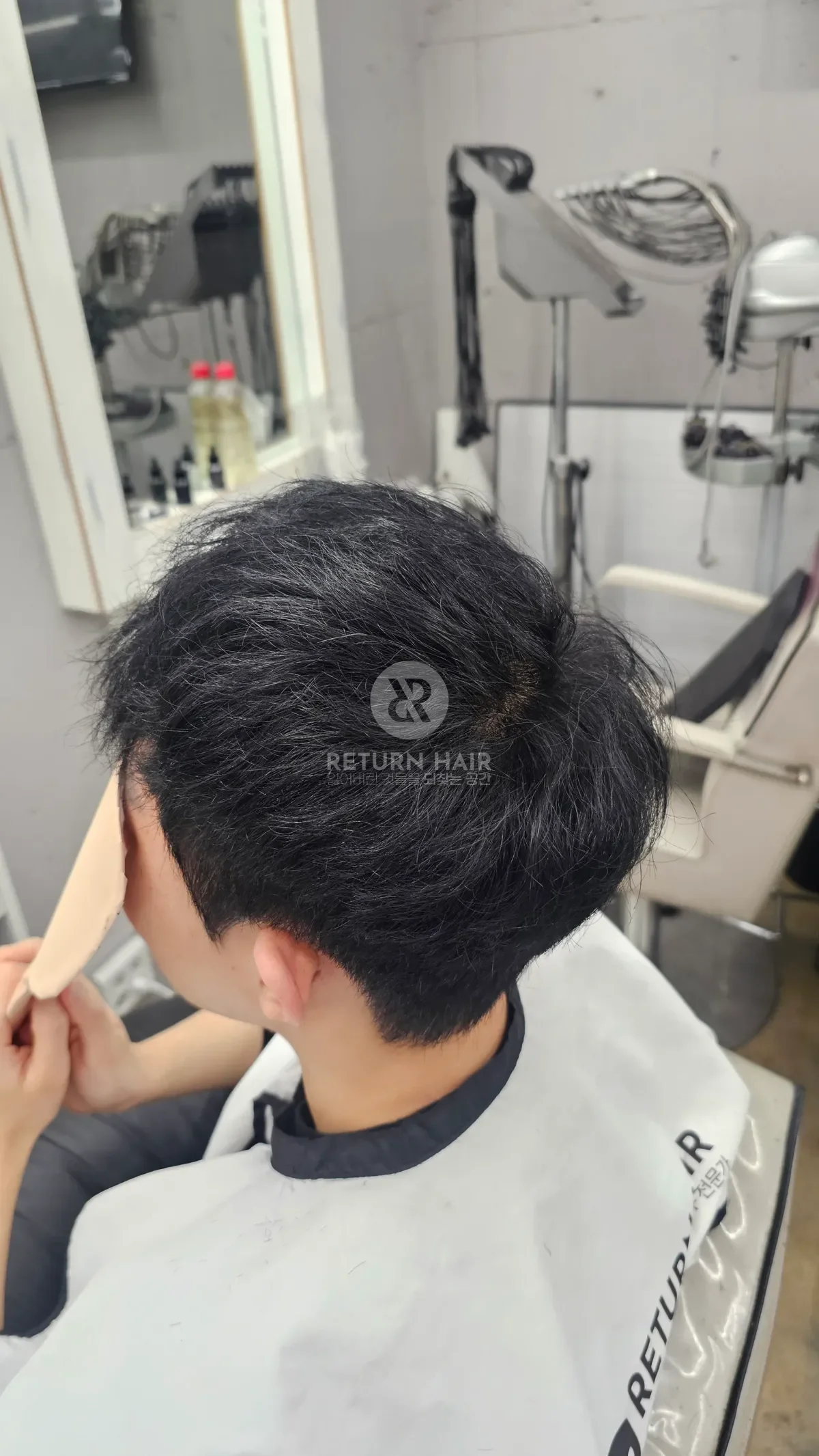 탈모 치트펌 파마 시술 후 결과 사진